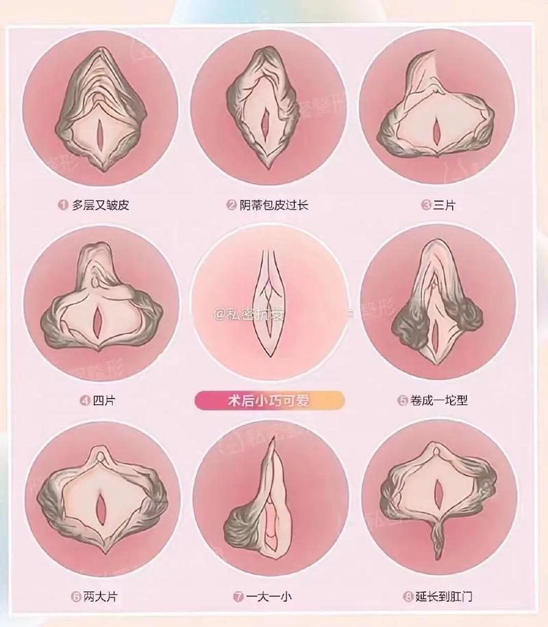 女性私密