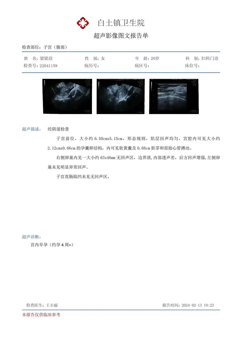 孕早期检查