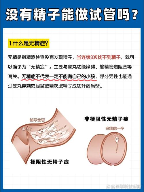无精试管技术