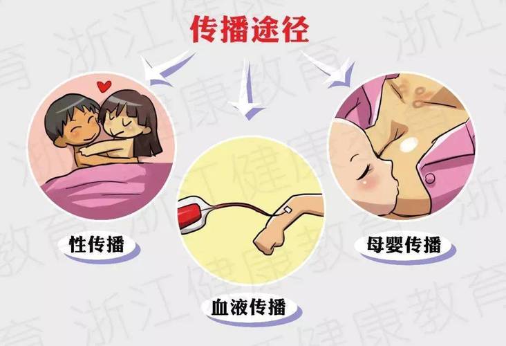 性传播