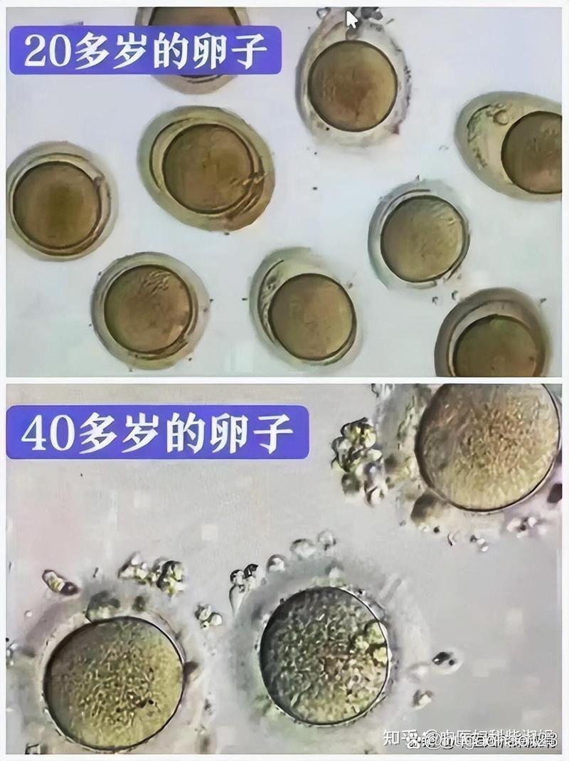 卵子椭圆度