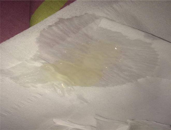 健康精子