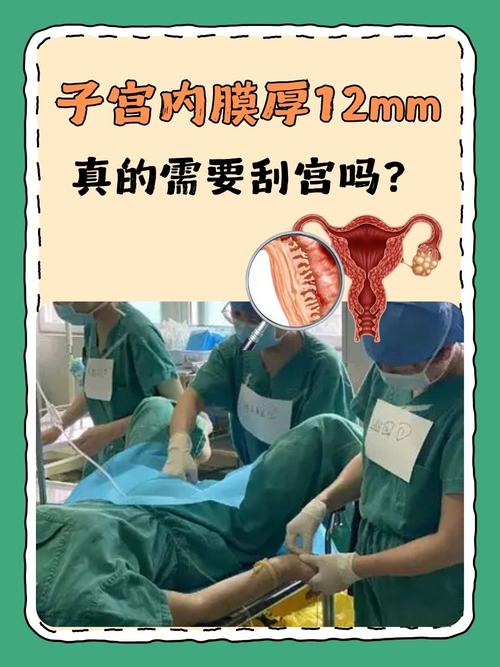 内膜刺激术