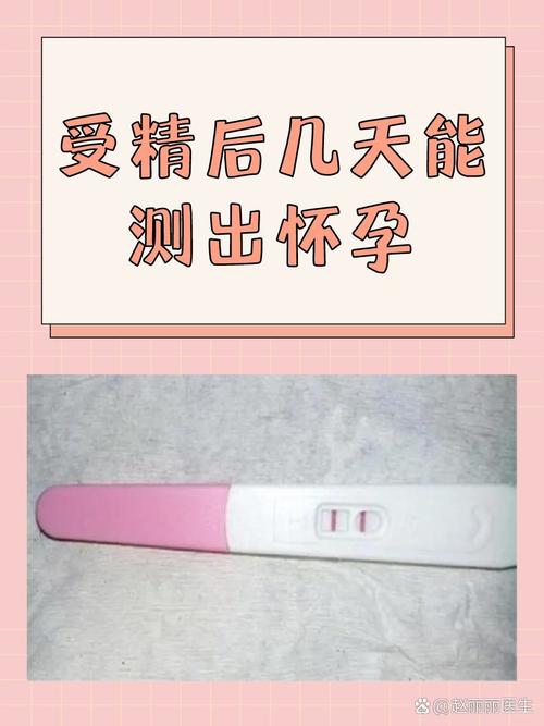 着床后20天