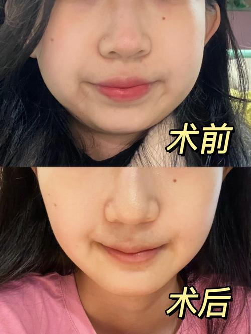 术前术后