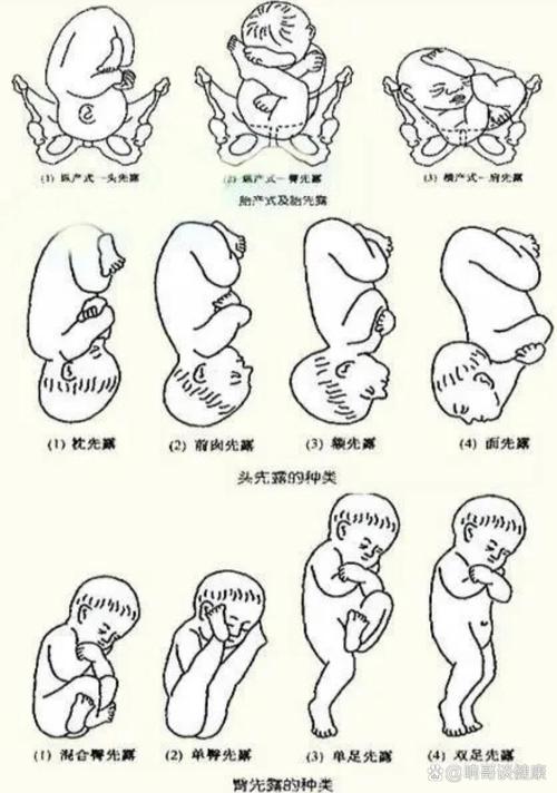胚胎错误识别