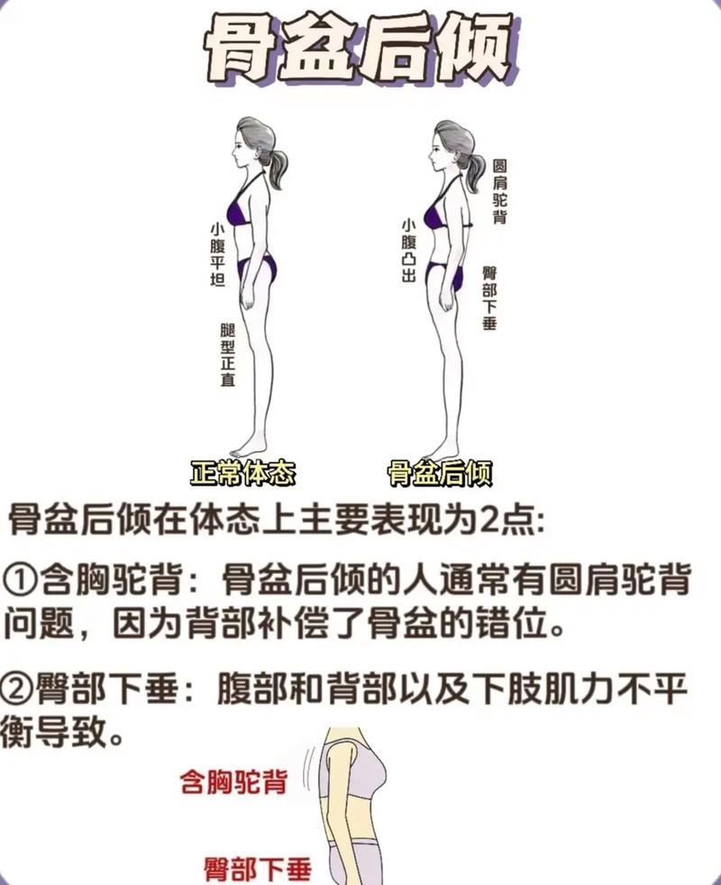 后倾位