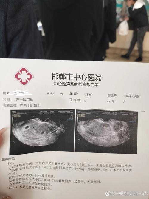 40天未见胎心