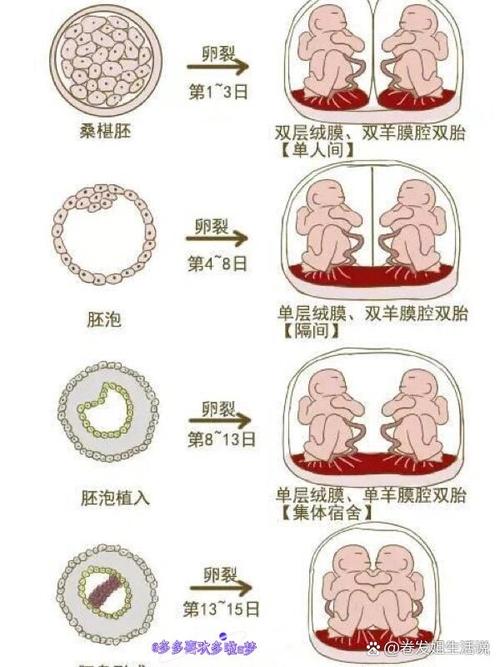 双胎发育