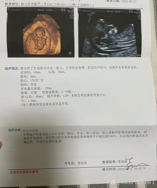 12周健康检查
