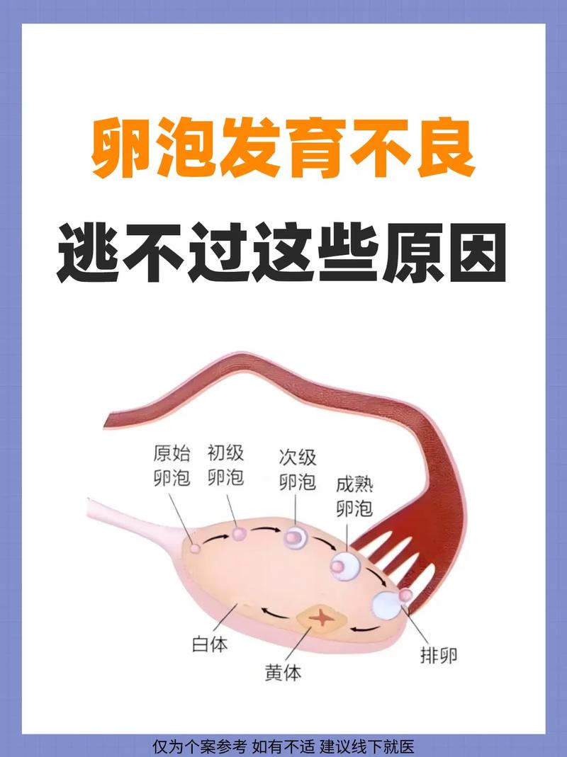 理想卵泡
