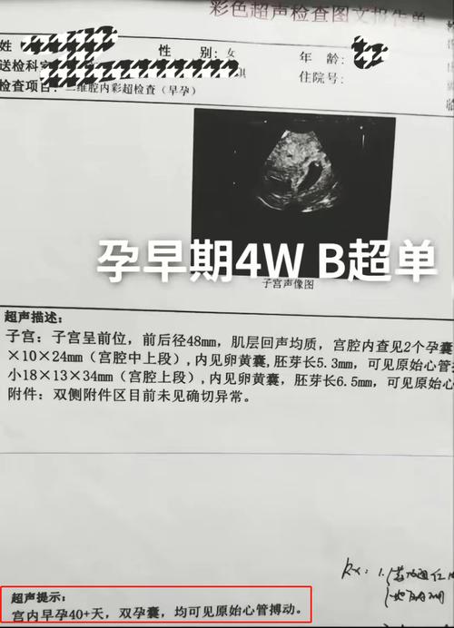 45天B超检查