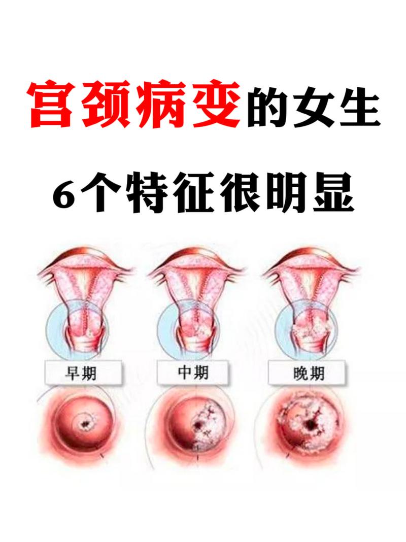 子宫疾病