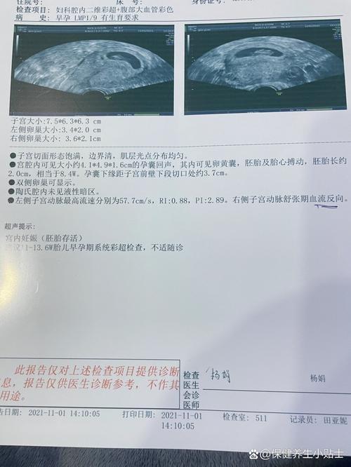 肝素保胎