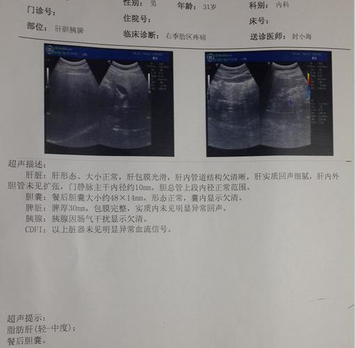 肝部B超检测