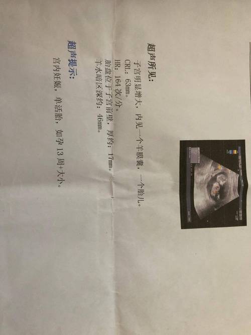 孕期B超检查