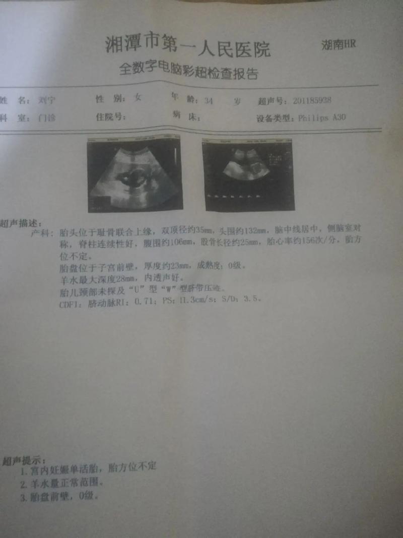 三个月无胎心