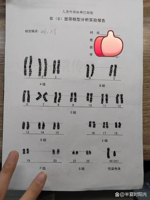 染色体核型分析