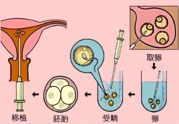 胚胎交换