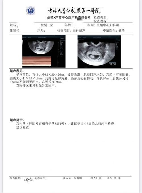 移植后42天