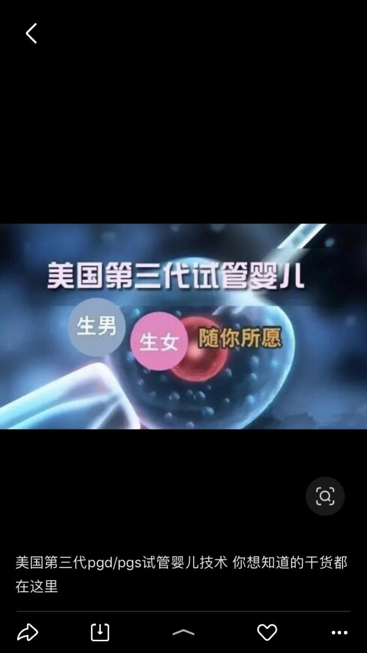 PGD试管婴儿