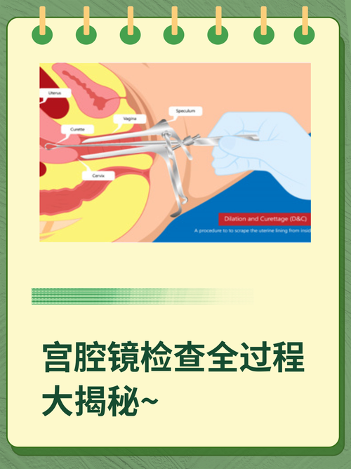 子宫检查