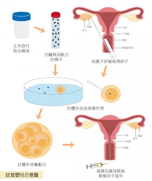 试管婴儿原理