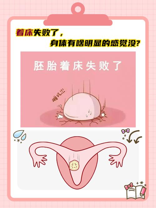 着床不稳定