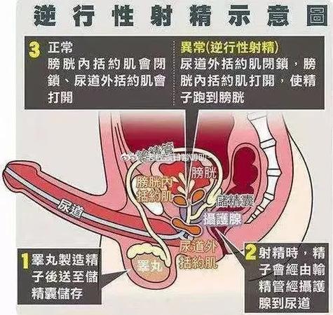 逆行精子