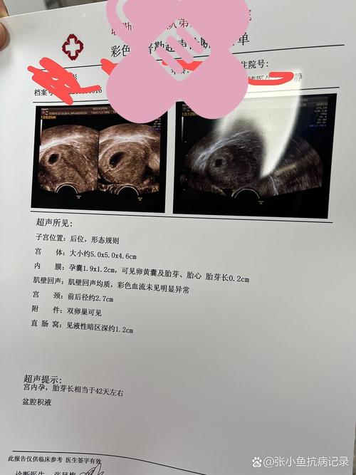 六周胎心