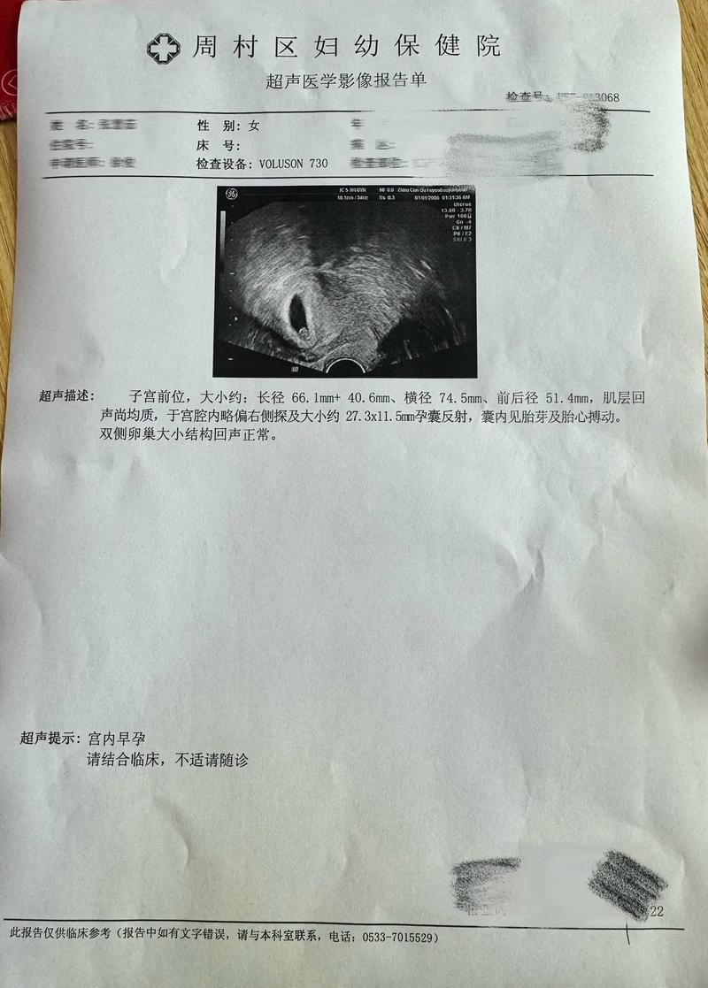 未显示胎心