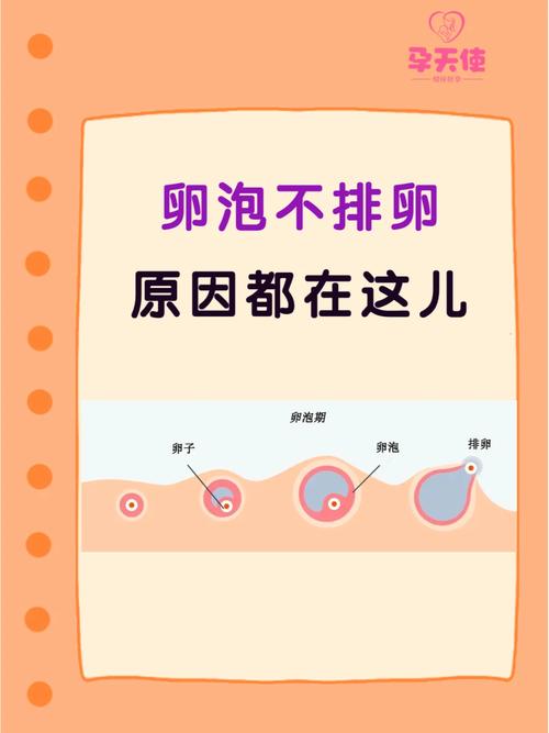 卵泡不排卵