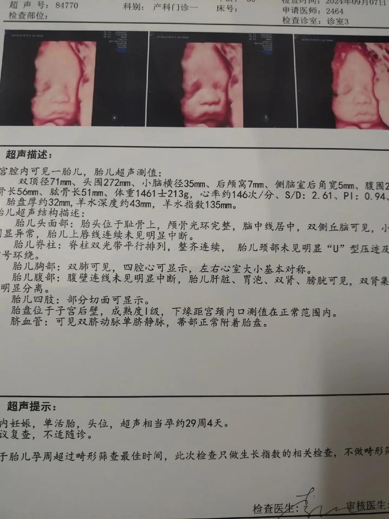 胎儿畸形筛查
