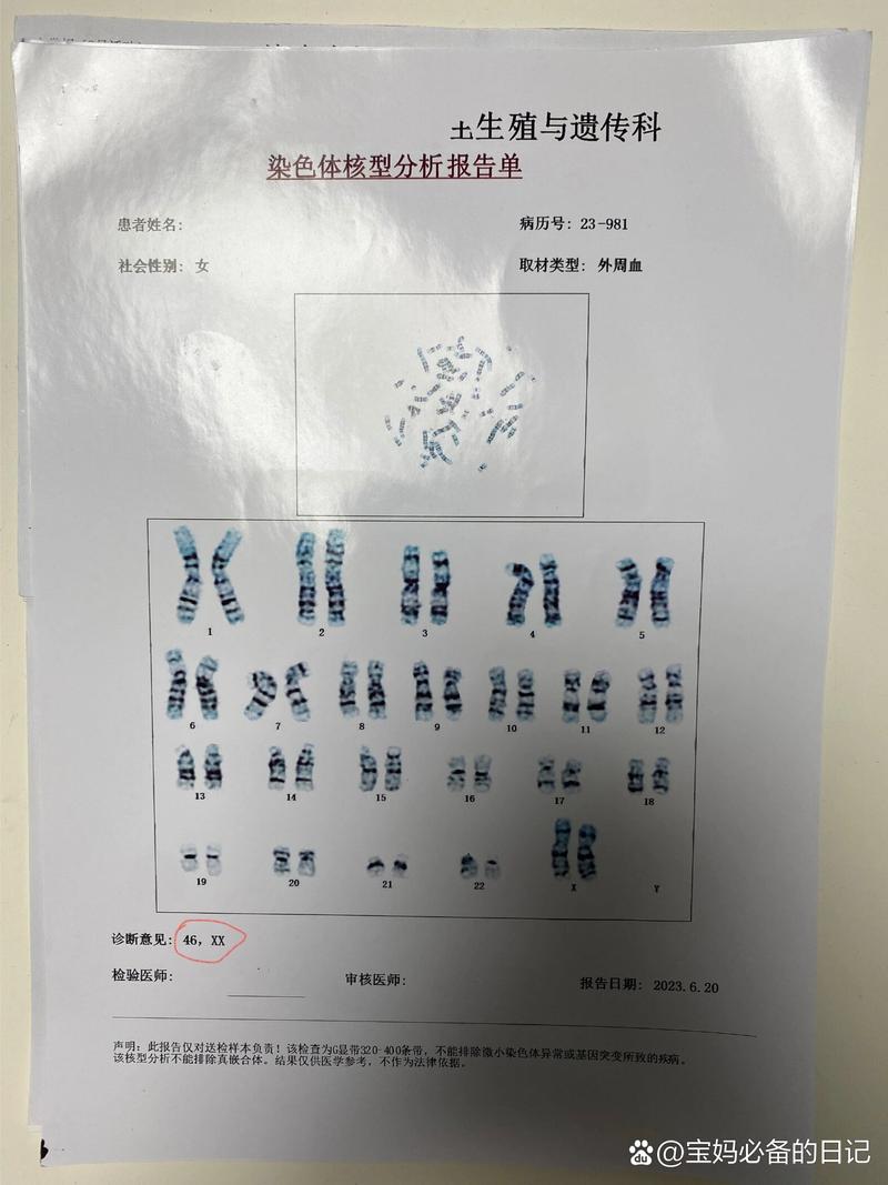  染色体筛查