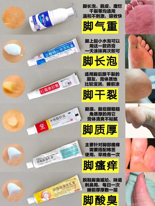 预防脚气