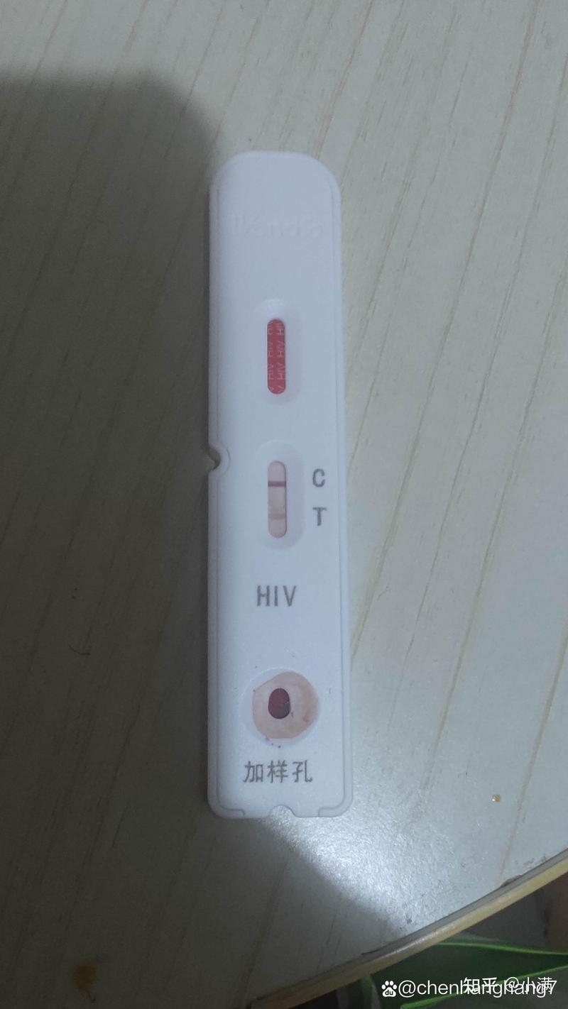 HIV试管检测