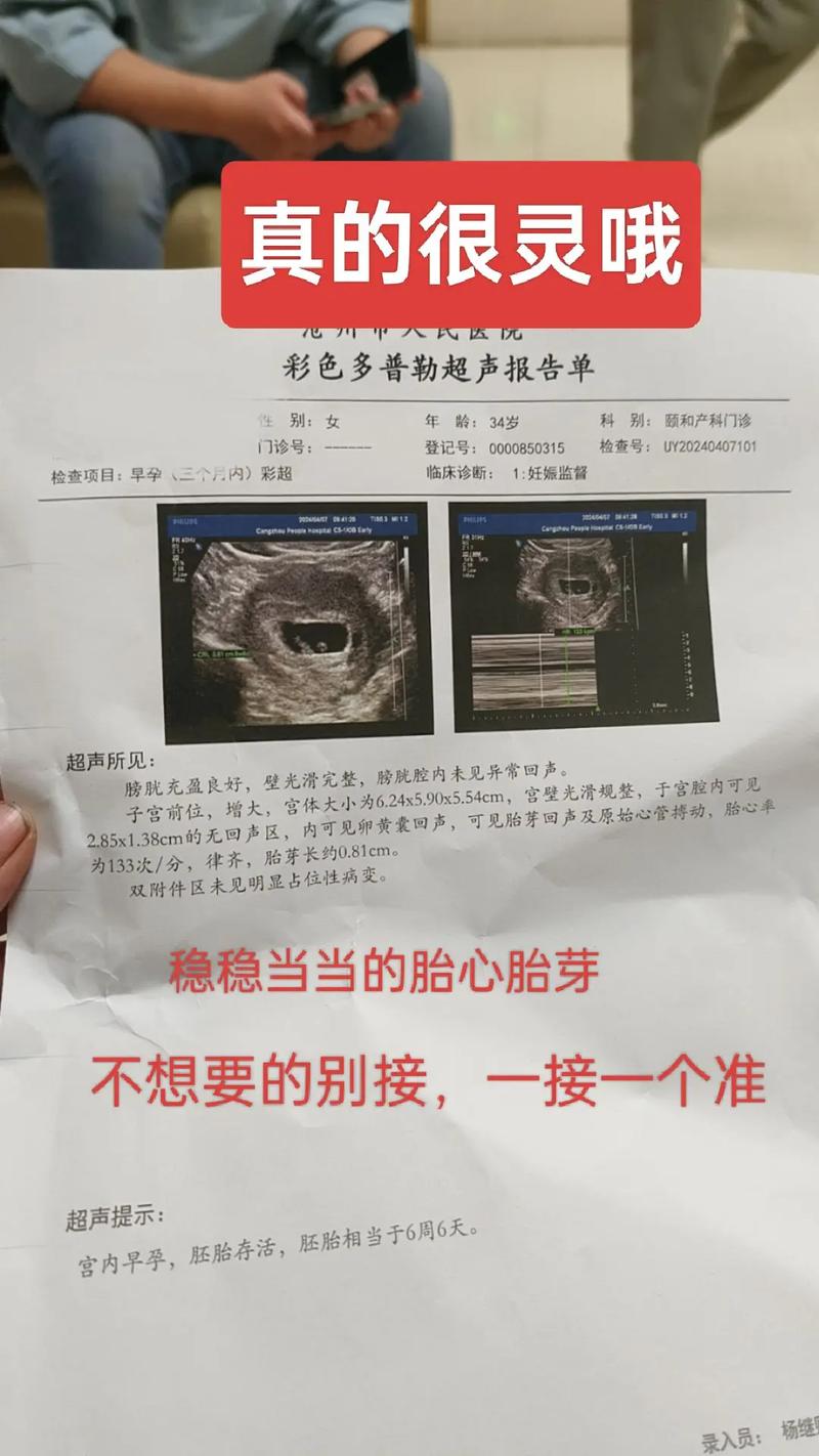 胎心缺失