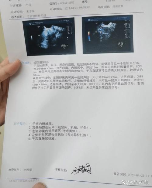 宫外孕

好的