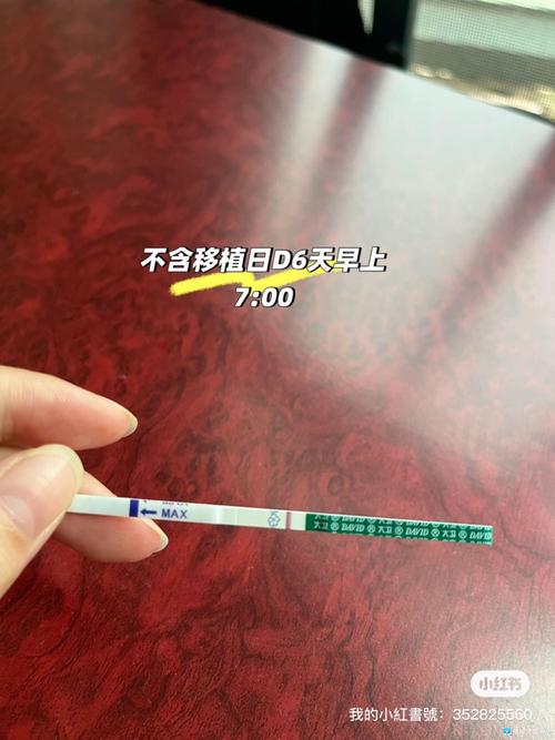 22号移植