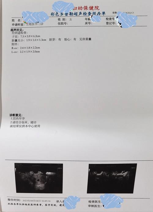 30天未见胎心