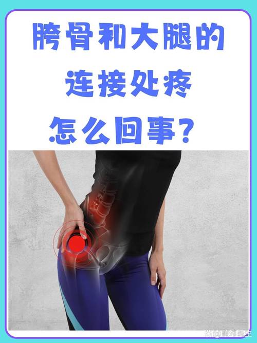移植后胯疼