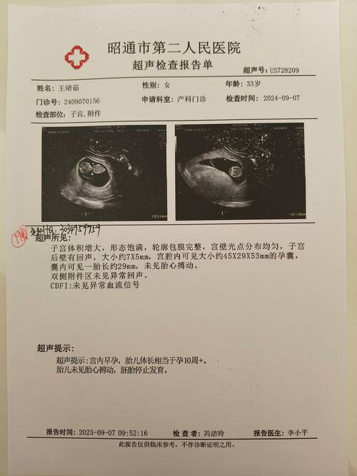 B超单子解析