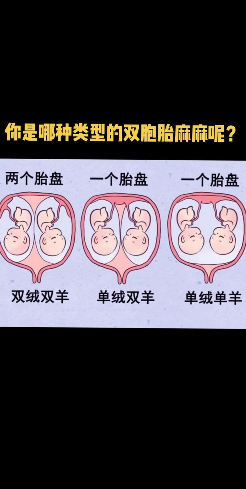 双绒双羊双胞胎