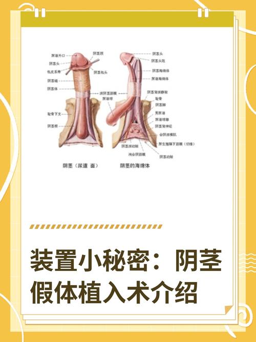 男性身体移植