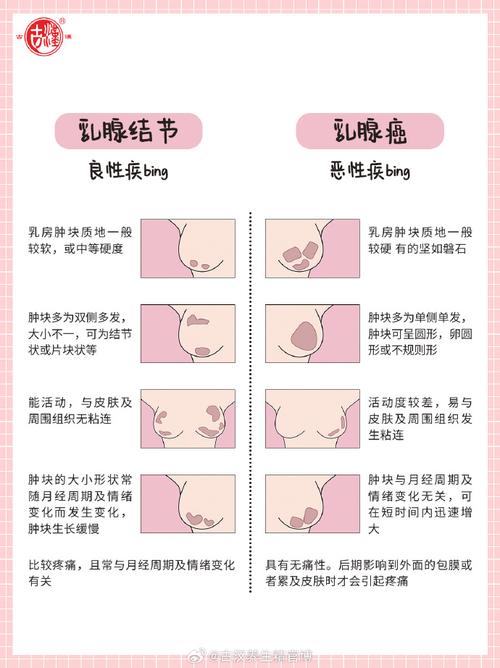  乳腺结节