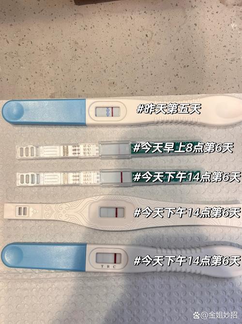 移植六天