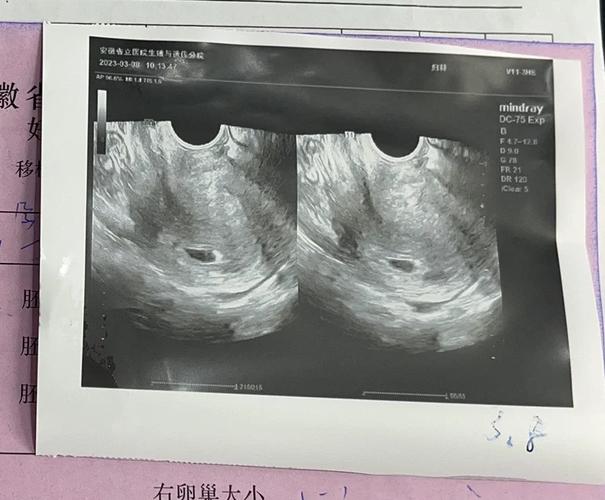 移植成功19天