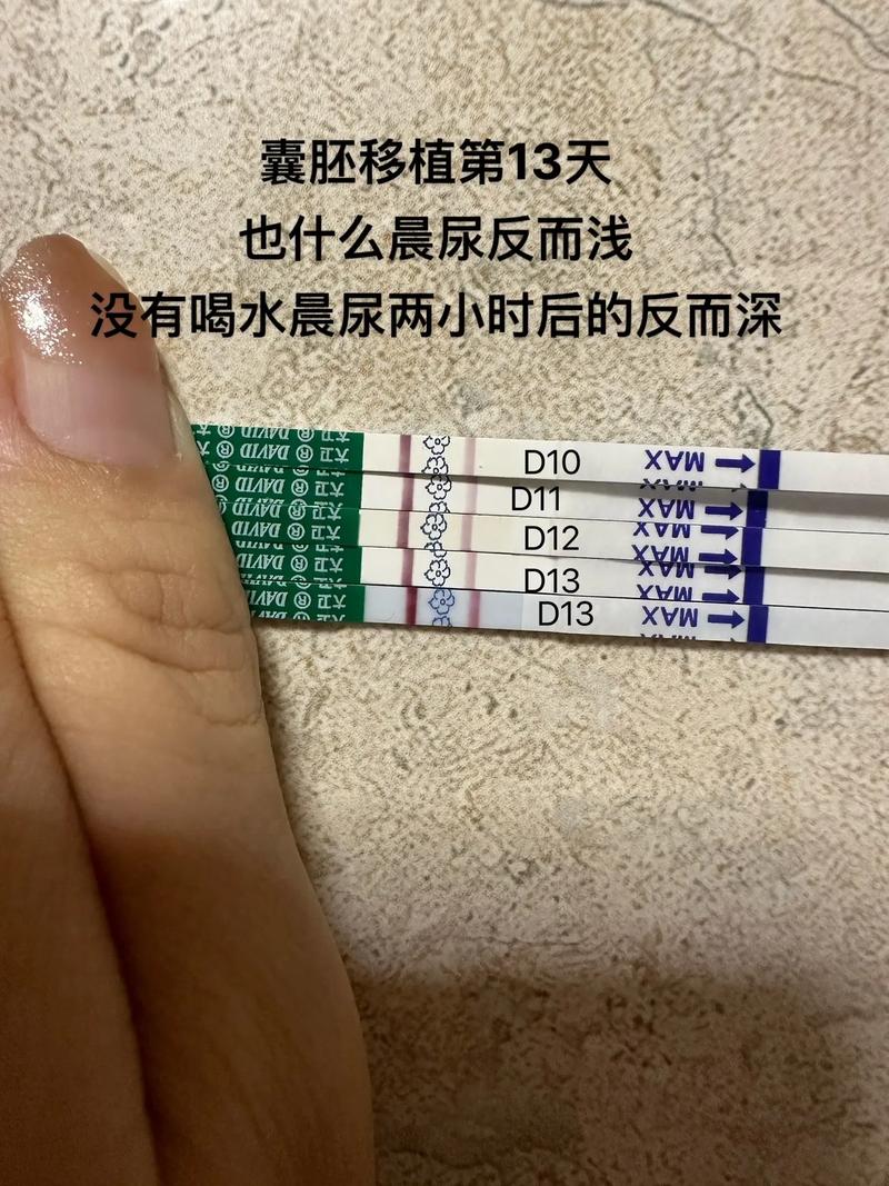 移植十三天