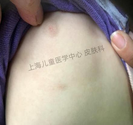  发育异常