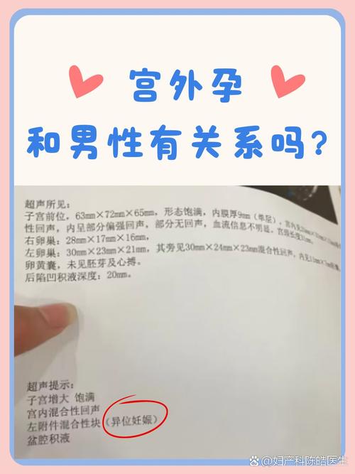 宫外孕概率